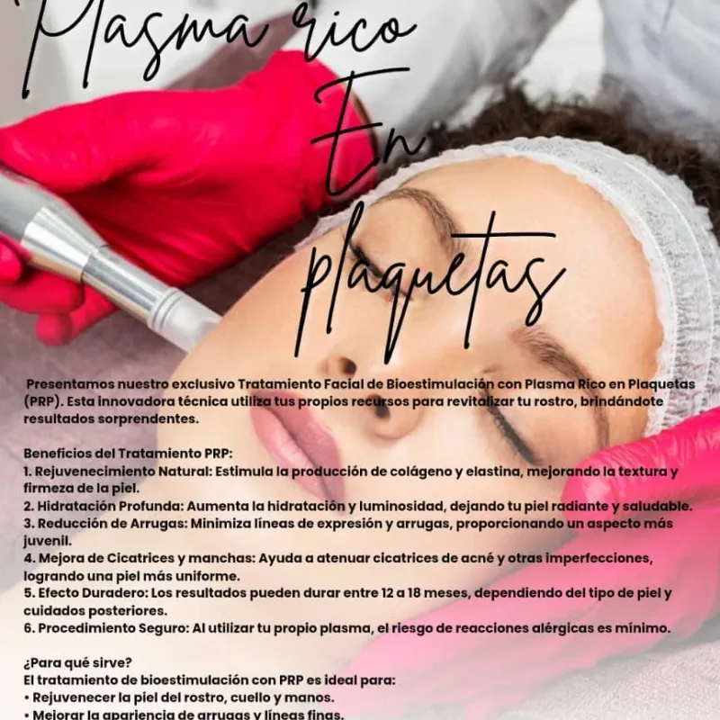 Bioestimulacion Plasma Rico en plaquetas