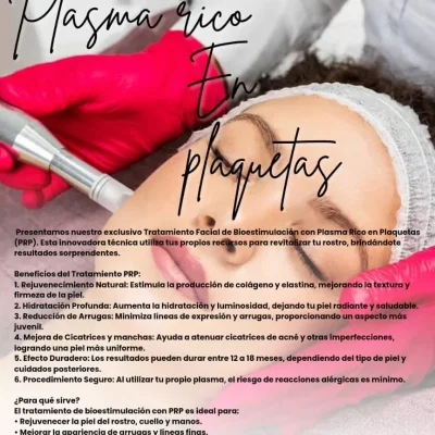 Bioestimulacion Plasma Rico en plaquetas