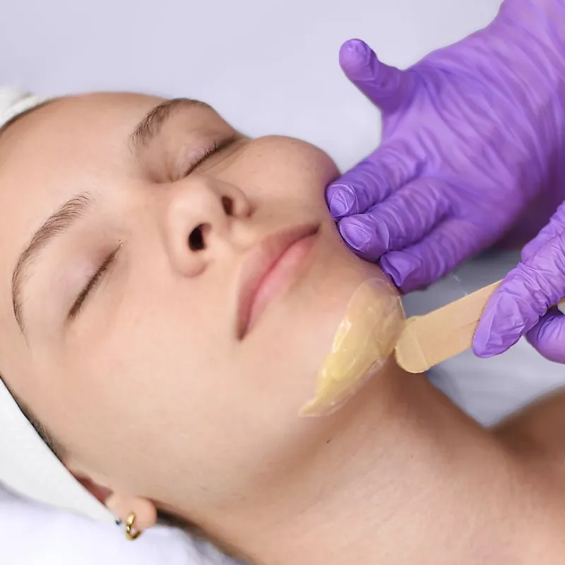 Depilación de mentón