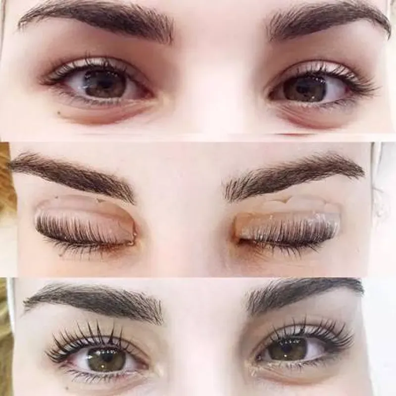 LIFTING DE PESTAÑAS