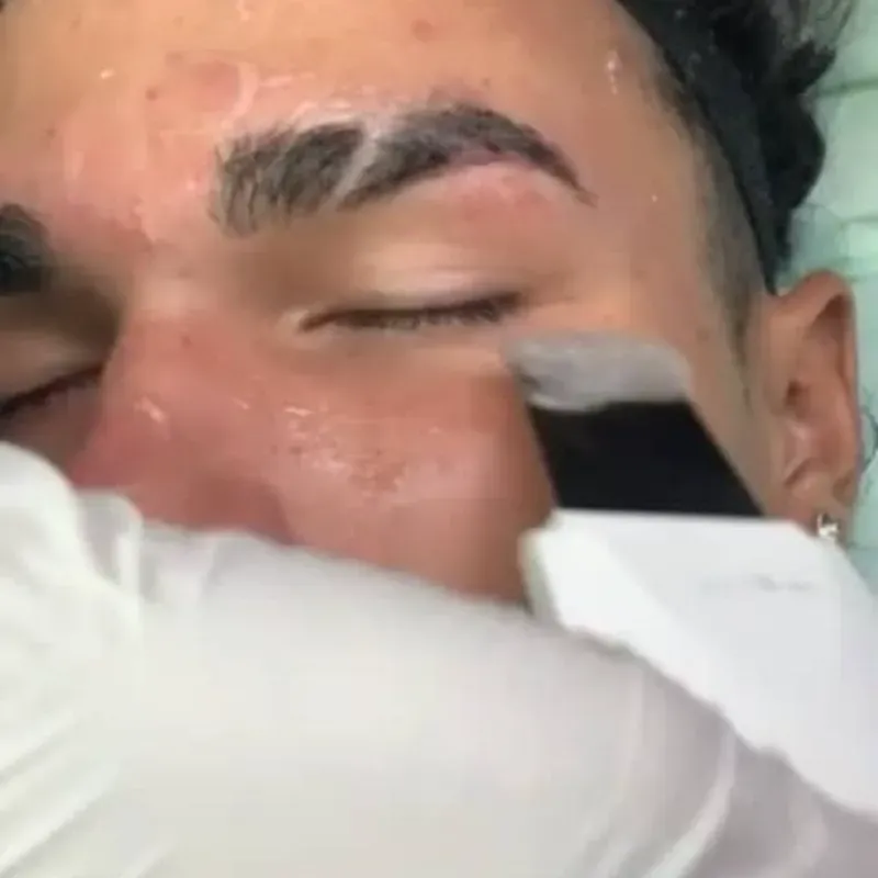 Espátula ultrasónica