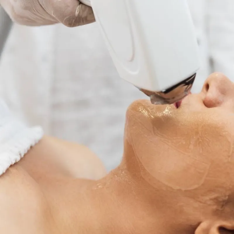 Bozo/Labio Superior✨