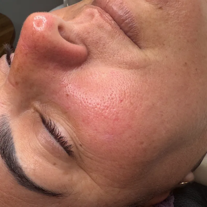 Limpieza Facial Básica