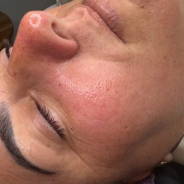 Limpieza Facial Básica