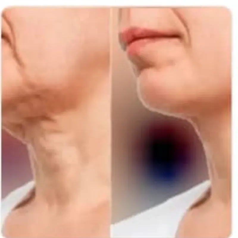 Masaje Post Operatorio por planos