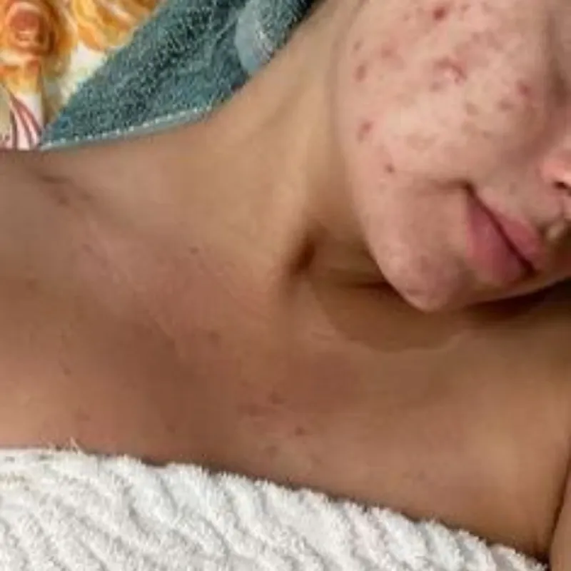 Higiene de Cuello y Pecho