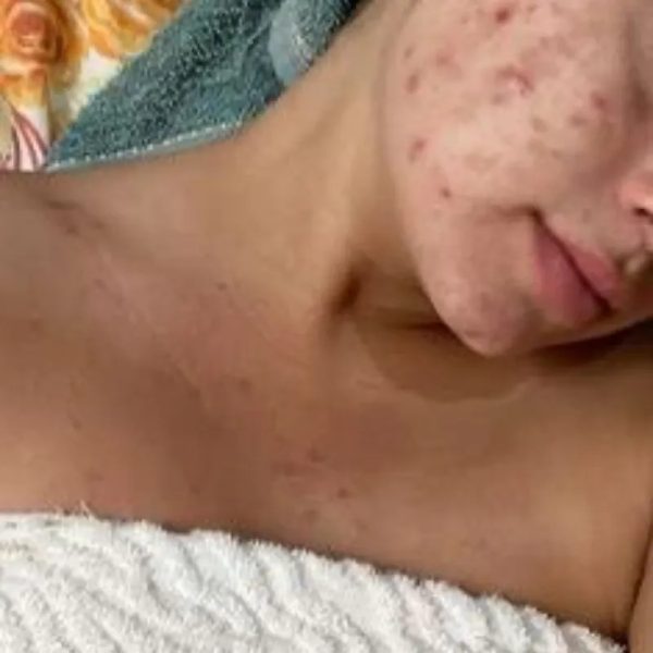 Higiene de Cuello y Pecho