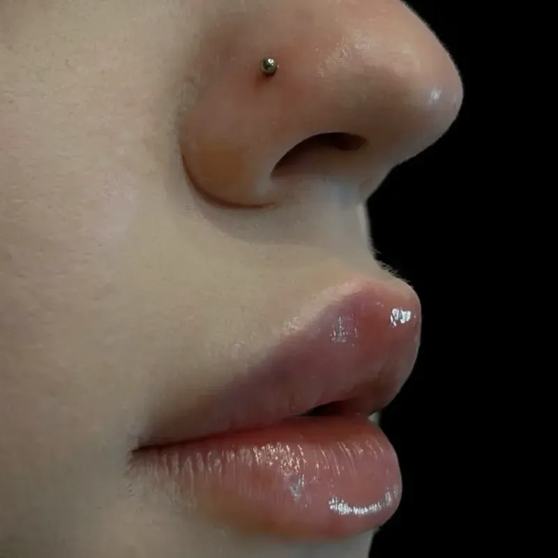 Nostril (lateral)