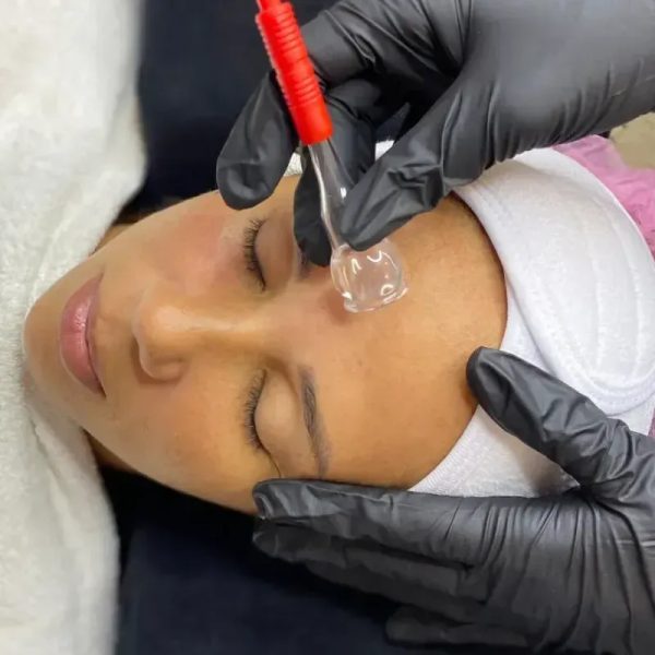 Limpieza FP con Vacum-terapia Facial