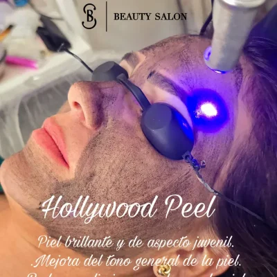 Hollywood Peel