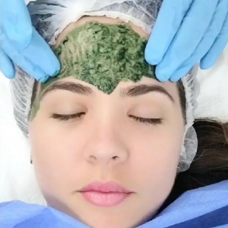 Biomicroneedling (Espículas)