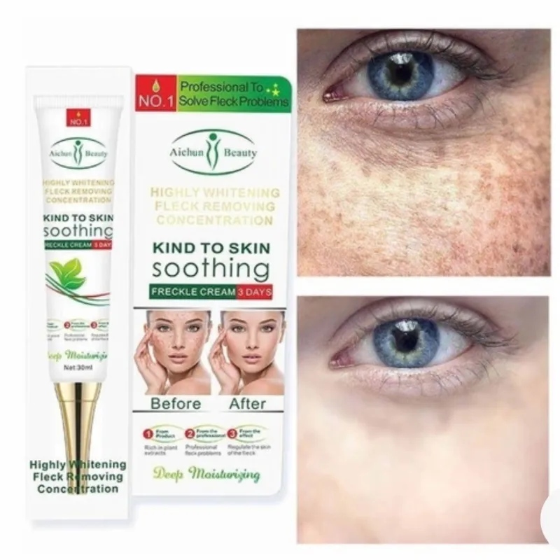 Crema Eliminadora de Manchas de Alto Blanqueamiento.