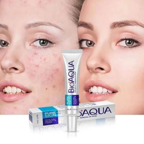 Loción para Acné Pure Skin