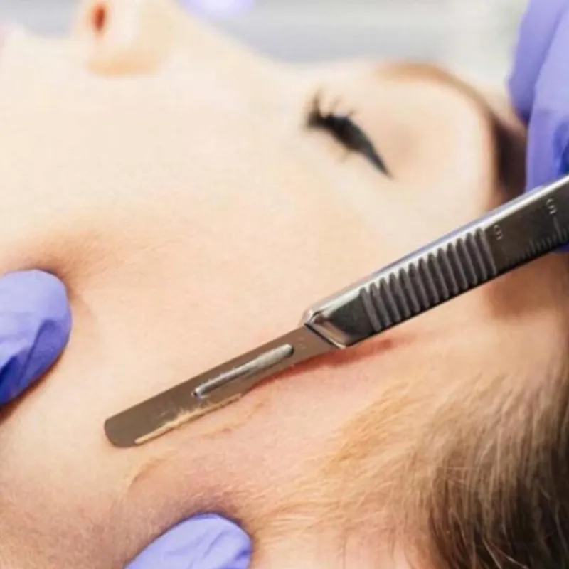 Limpieza Facial Profunda con Dermaplaning