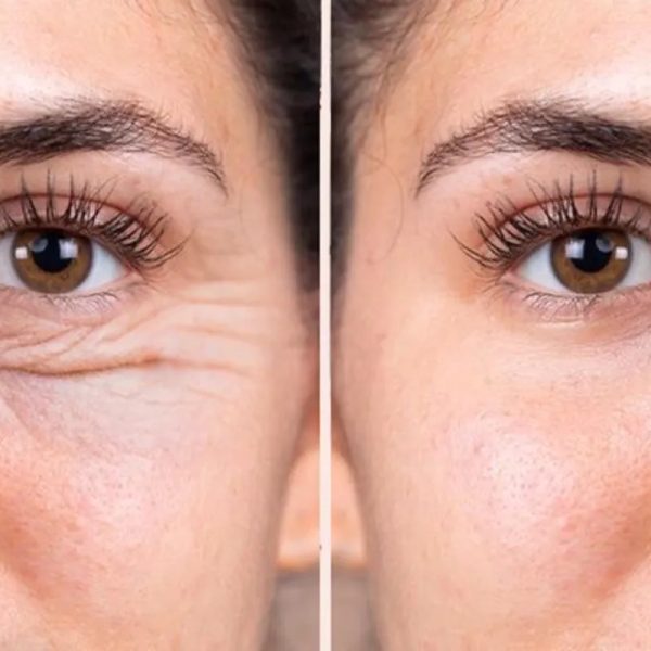 Ami Eyes contorno de ojos y ojeras