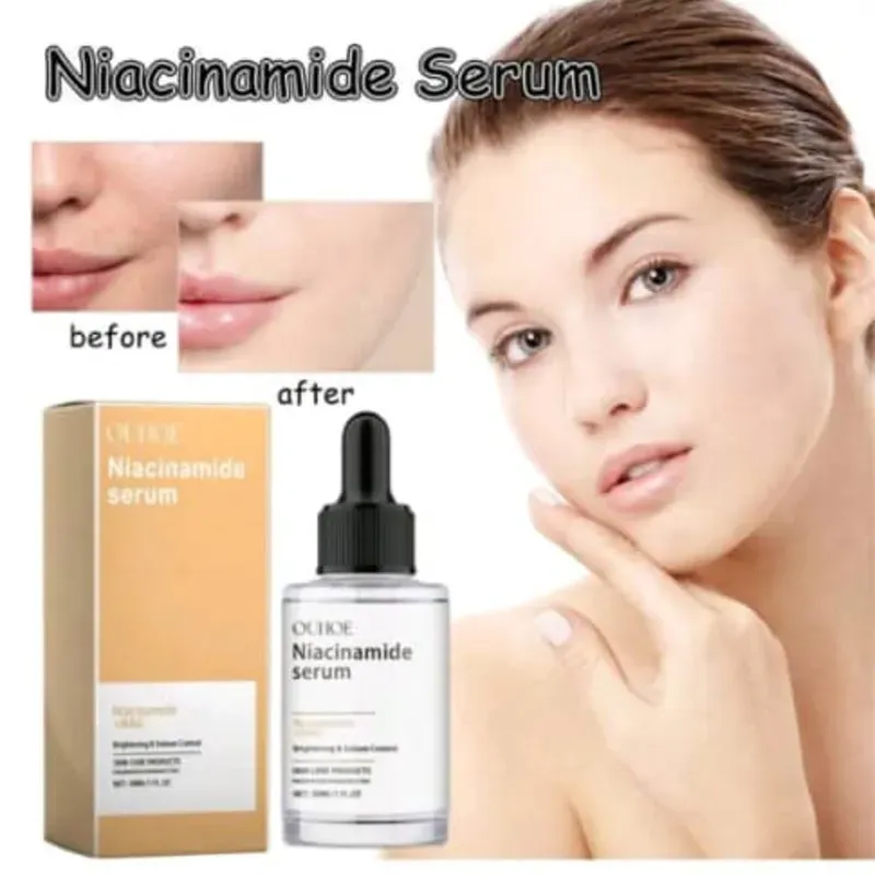 Serum de niacinamida