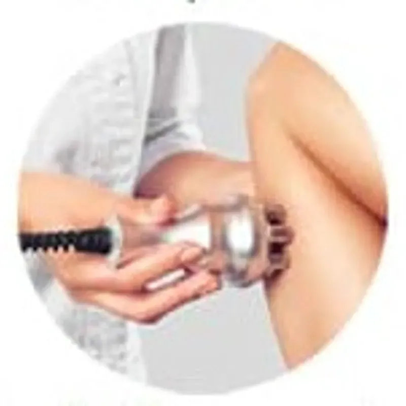 Radiofrecuencia en abdomen y glúteos