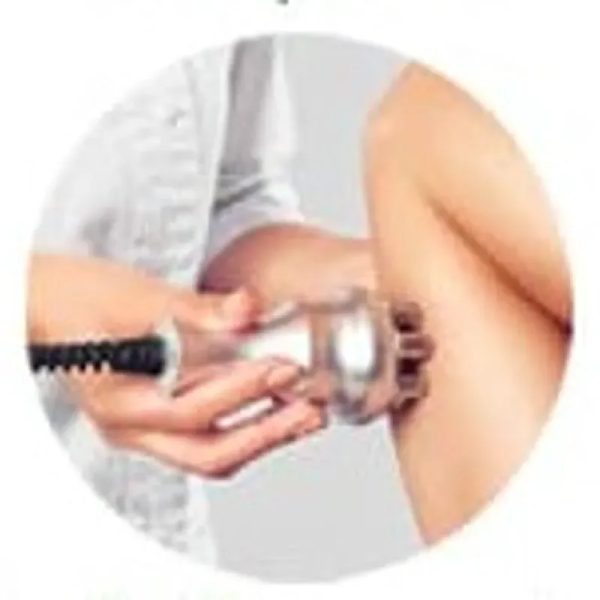 Radiofrecuencia en abdomen y glúteos