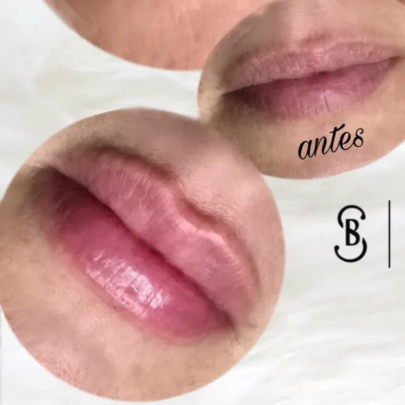 BBLIPS Hidratación de labios