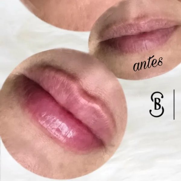 BBLIPS Hidratación de labios