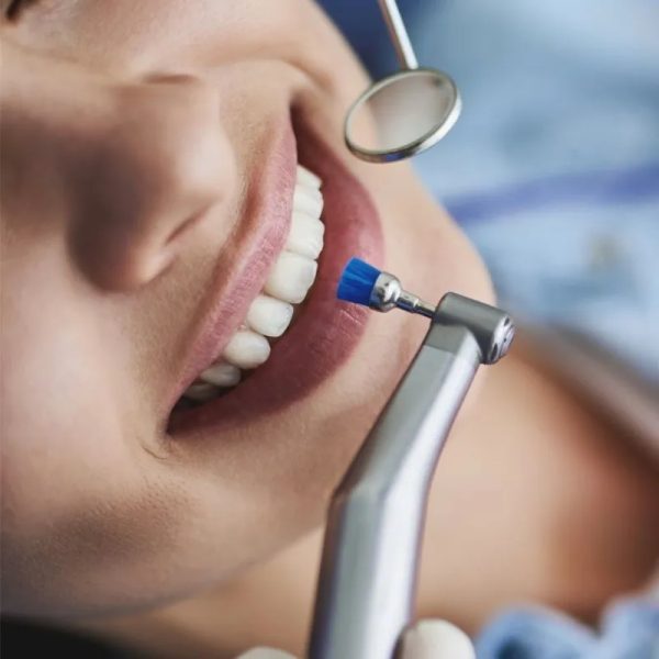 Limpieza Dental