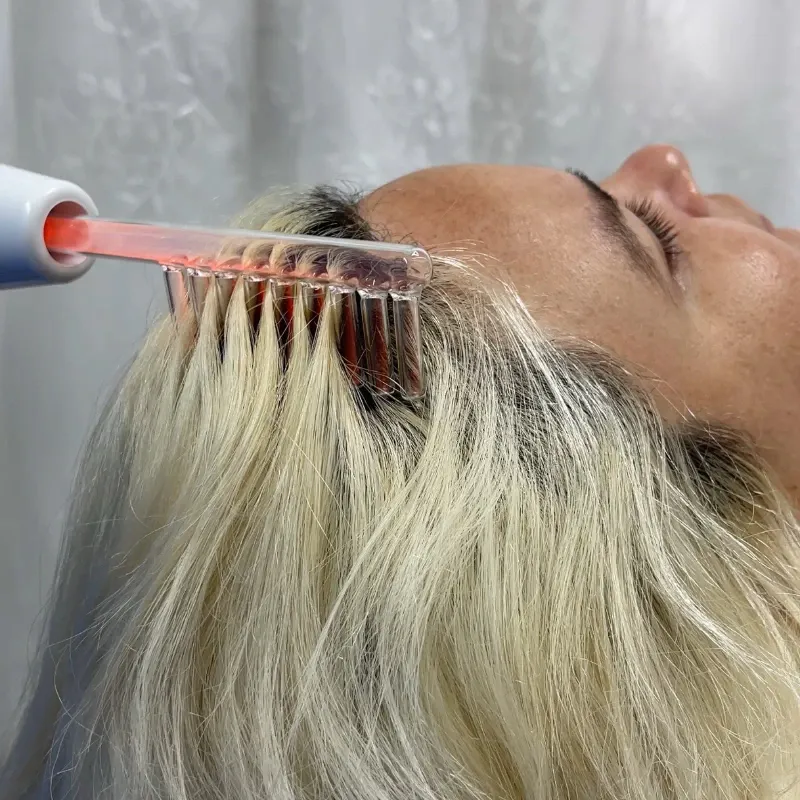 Alta Frecuencia Capilar