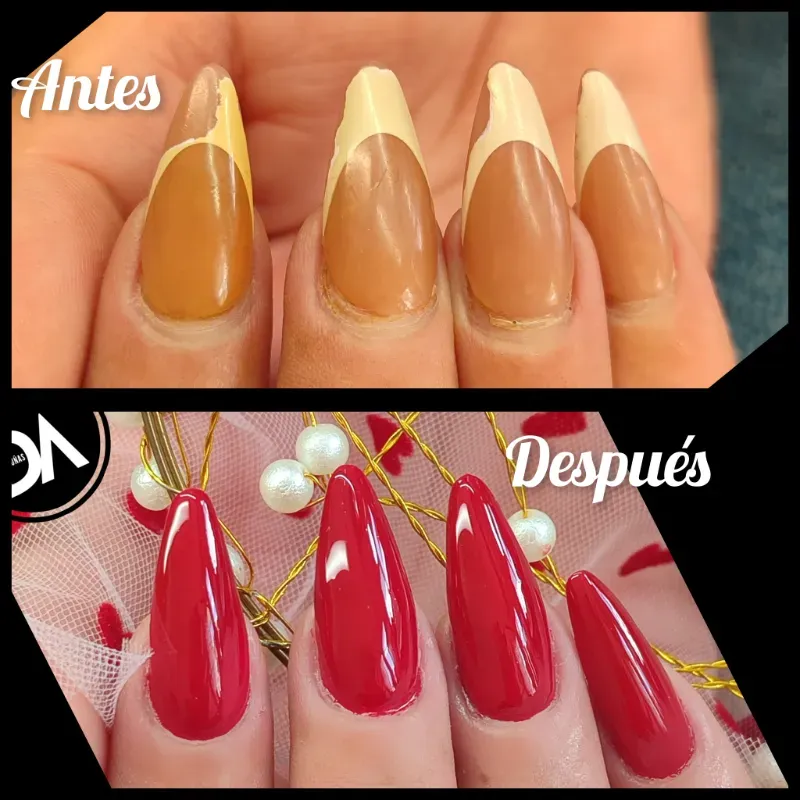 Reparación de las uñas 15 a 17 días