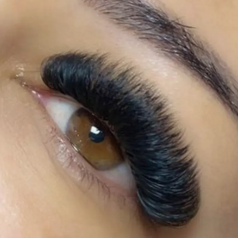 Relleno de mega volumen