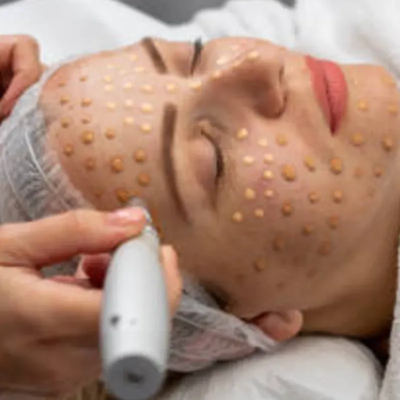 BB GLOW PIEL DE PORCELANA