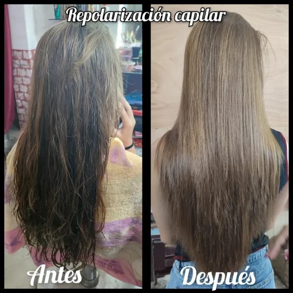 Repolarización capilar