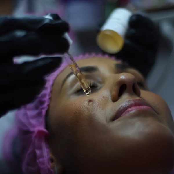 Tratamiento facial despigmentante