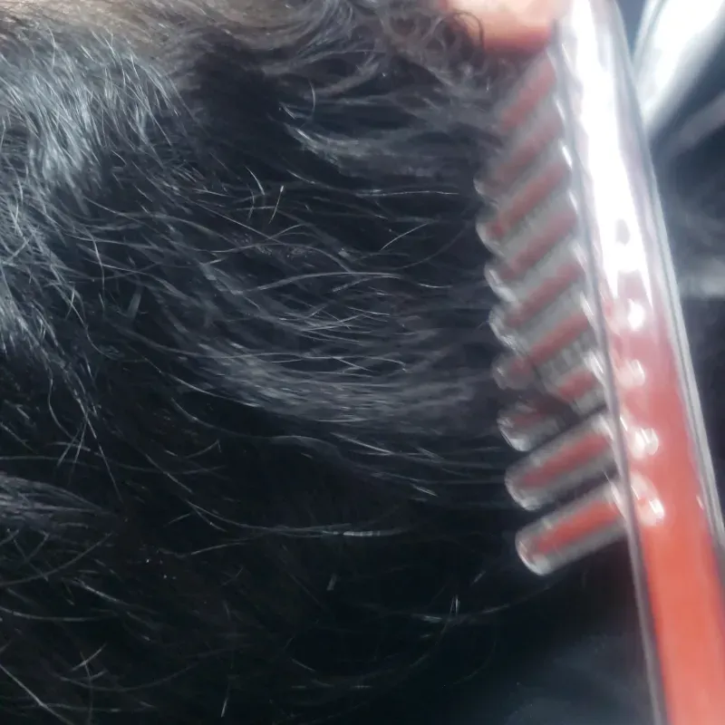 Alta frecuencia capilar