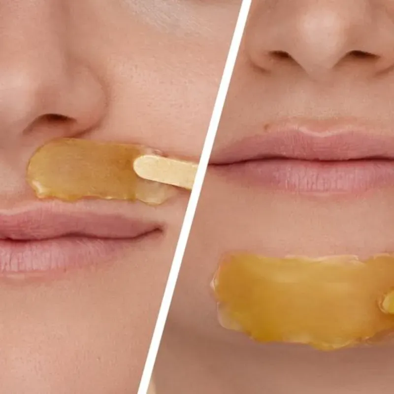 Depilación de Bozo  o Mentón