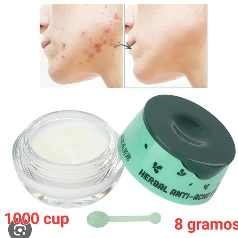 Crema herbal antiacne