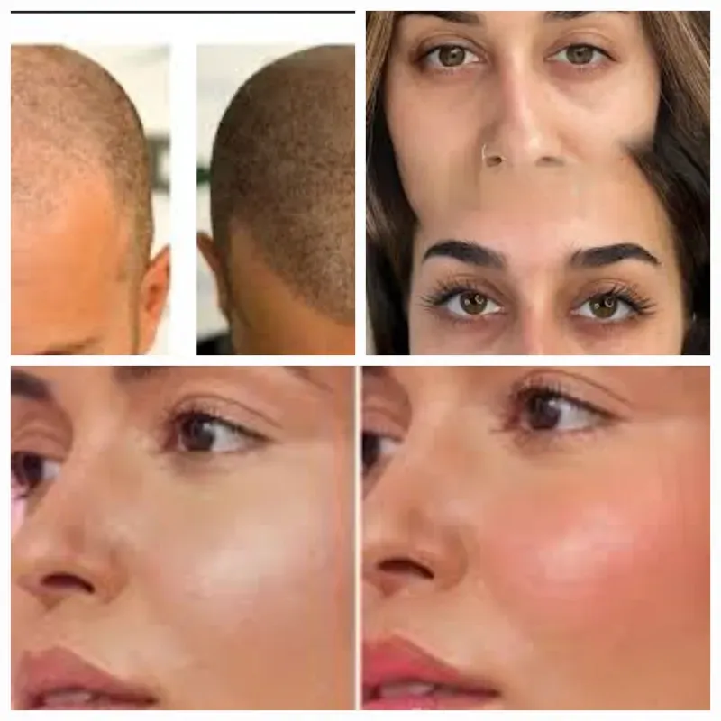 Otros servicios de Micropigmentación (Maquillaje semipermanente )