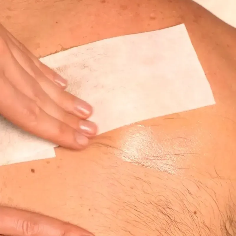 Depilación de espalda