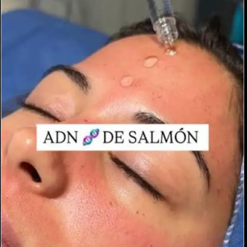 Terapia con ADN de Salmón