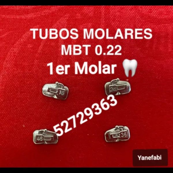 Tubos Molares. 1er Molar