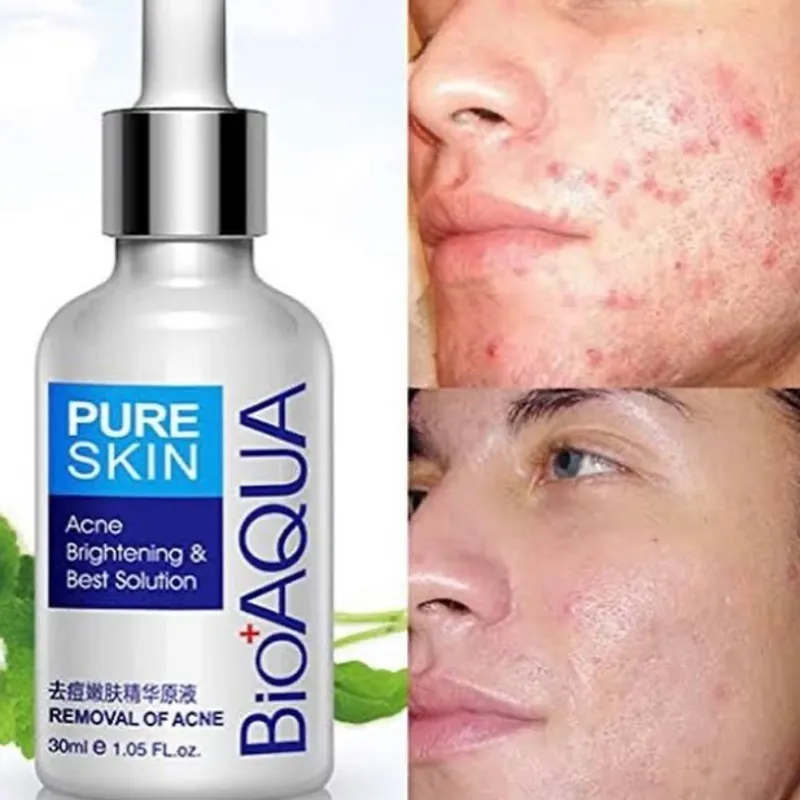 SERUM ANTI ACNE BIOAQUA.