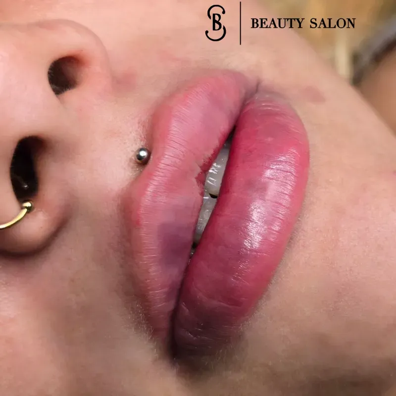 Retoque Micropigmentación de Labios