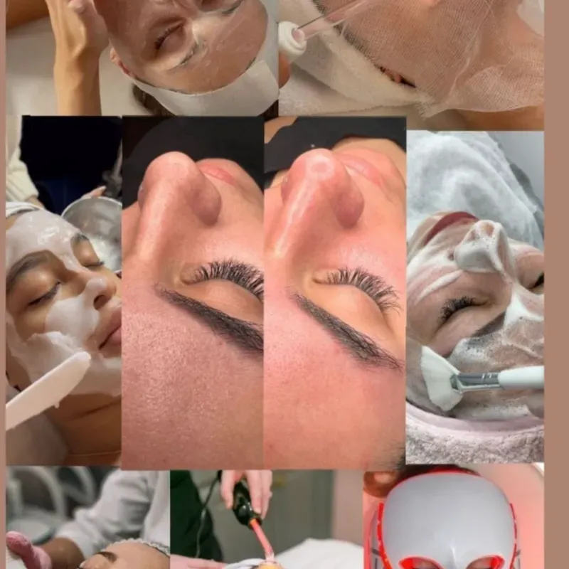 Limpieza facial profunda