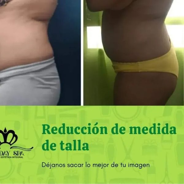 Abdomen