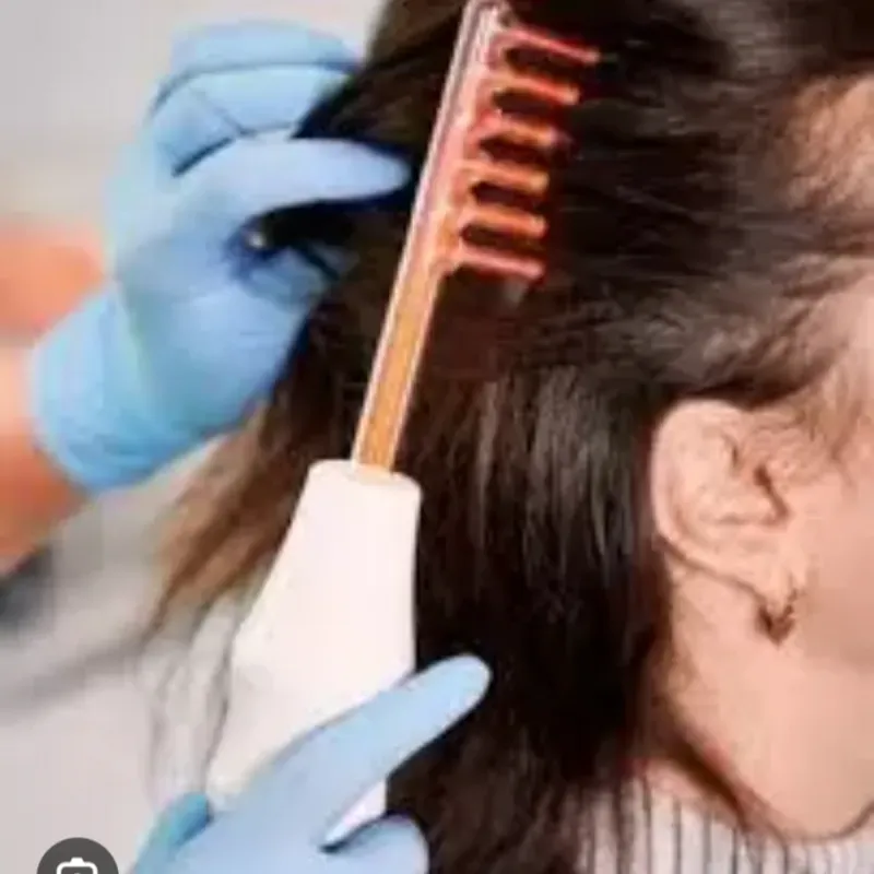 ALTA FRECUENCIA CAPILAR