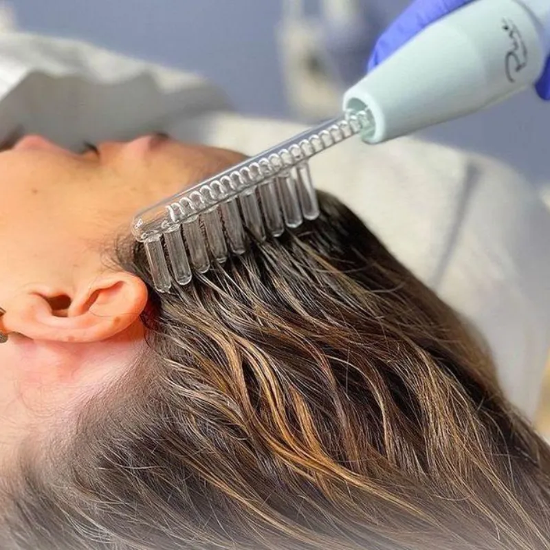 Alta frecuencia capilar