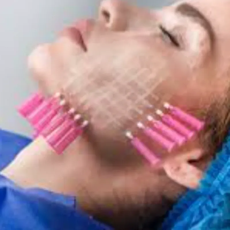 Hilos de polidoxanona ( Pdo)