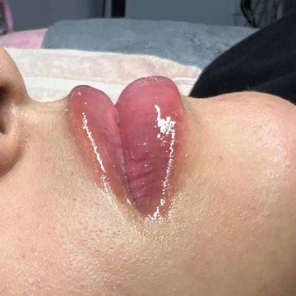 Hidraluz Lips