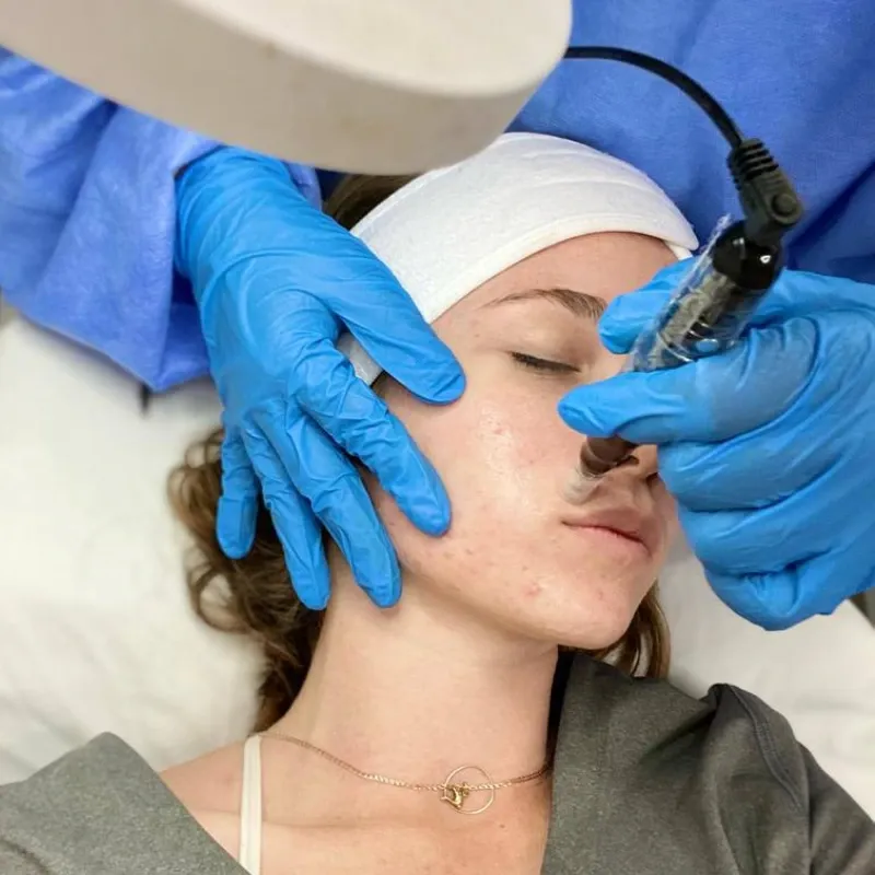 Micropunción Premium