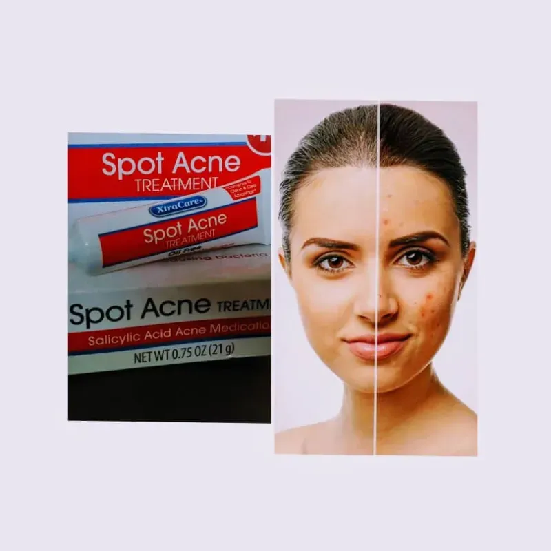 XtraCare Tratamiento para el Acné