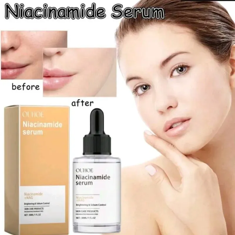 Sérum de niacinamida 10%+Nac8%