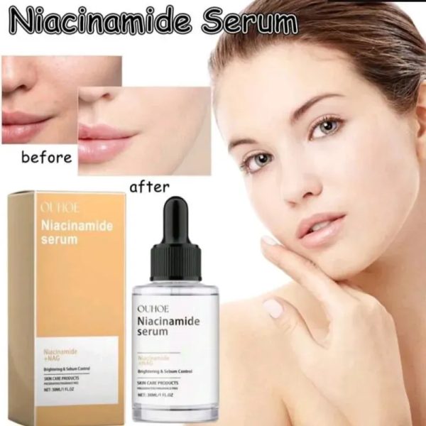 Sérum de niacinamida 10%+Nac8%